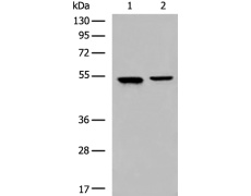 兔抗CYP2A13多克隆抗体