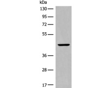 兔抗CYSLTR2多克隆抗体
