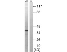 兔抗MAP2K3(Phospho-Thr222)多克隆抗体