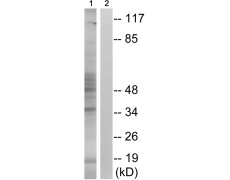 兔抗MAPKAPK2(Phospho-Ser272) 多克隆抗体