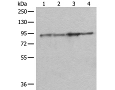 兔抗DDX1多克隆抗体