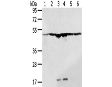 兔抗DDX39B多克隆抗体
