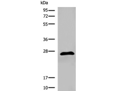 兔抗DGCR6多克隆抗体