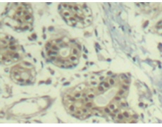 兔抗MDM2(phospho-Ser166)多克隆抗体