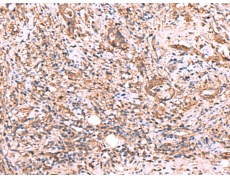  兔抗TTC38多克隆抗体  