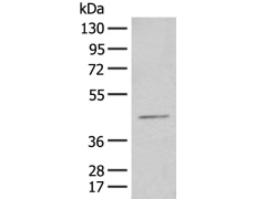 兔抗HENMT1多克隆抗体