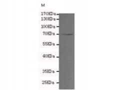 小鼠抗MMP2单克隆抗体