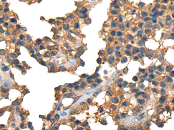 兔抗CTLA4多克隆抗体