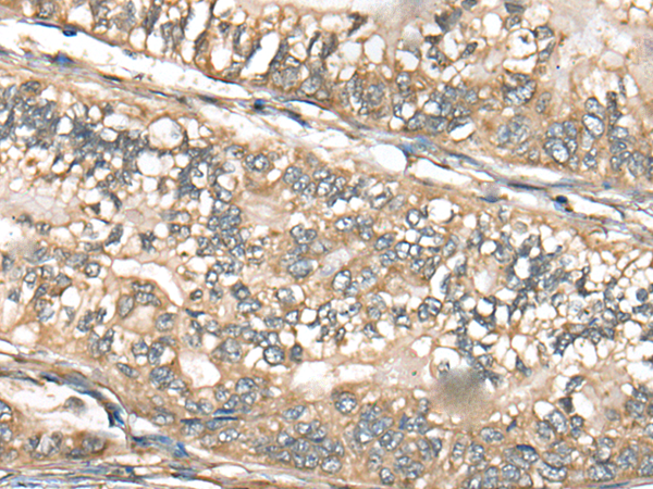 兔抗CTNNAL1多克隆抗体