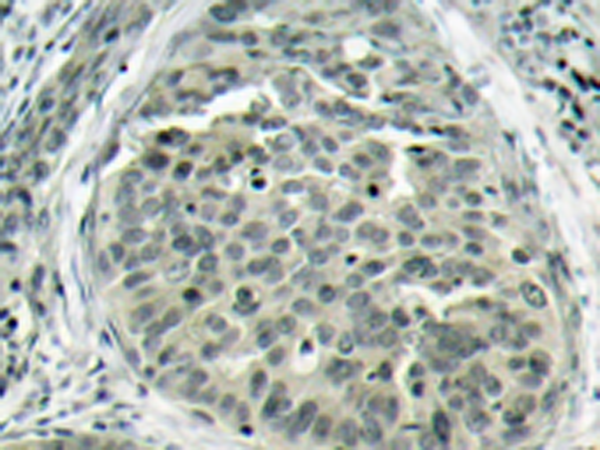 兔抗CTNNB1 (Phospho-Ser37)多克隆抗体