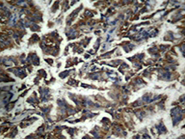 兔抗CTNNB1(phospho-Tyr333) 多克隆抗体