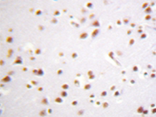 兔抗CTNND1(Ab-228) 多克隆抗体