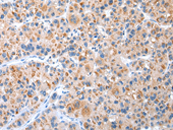 兔抗CXCR4多克隆抗体