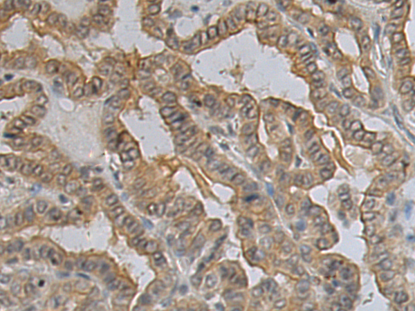 兔抗MAMDC2多克隆抗体