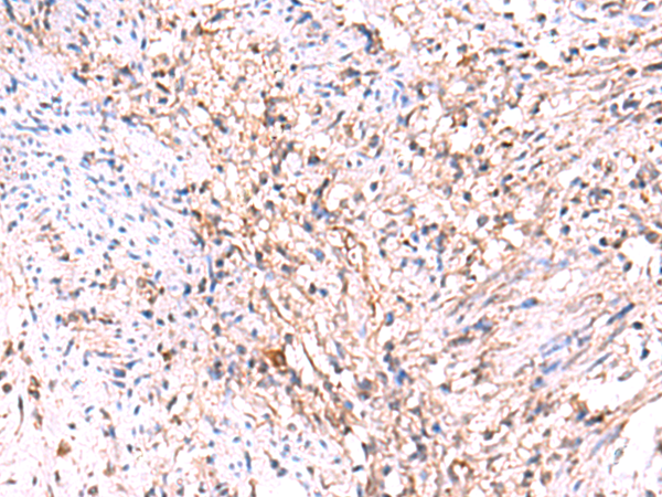 兔抗MANSC1多克隆抗体