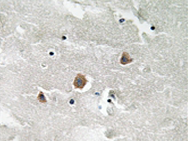 兔抗MAP3K1(Phospho-Thr1402)多克隆抗体