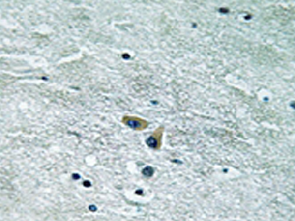 兔抗MAP3K8(Ab-400)多克隆抗体