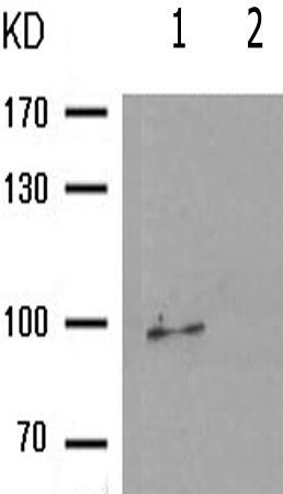 兔抗PGR(Phospho-Ser400)多克隆抗体