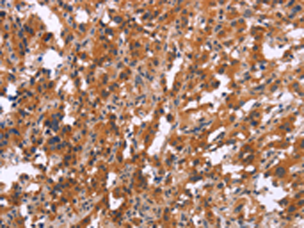 兔抗MAPK11多克隆抗体