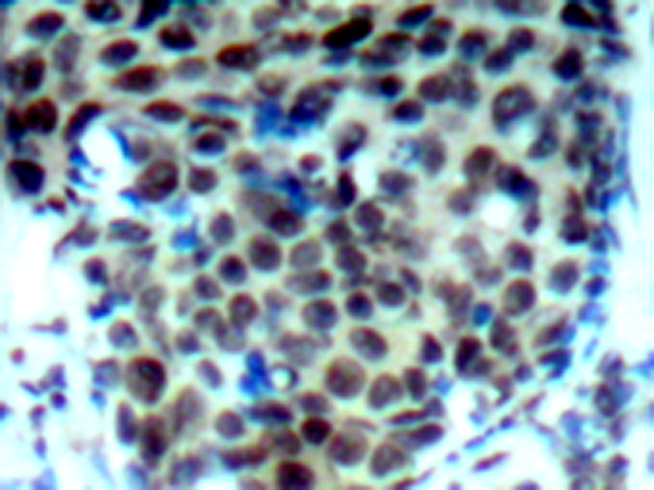 兔抗MAPK14 (Phospho-Thr180)多克隆抗体