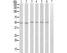 兔抗TUBA3C/E多克隆抗体 