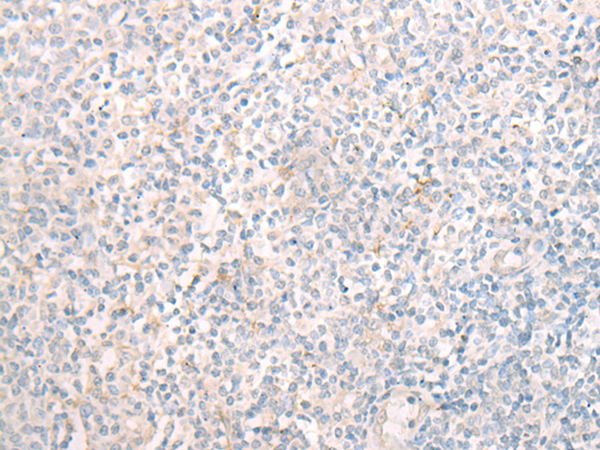 兔抗MBOAT7多克隆抗体