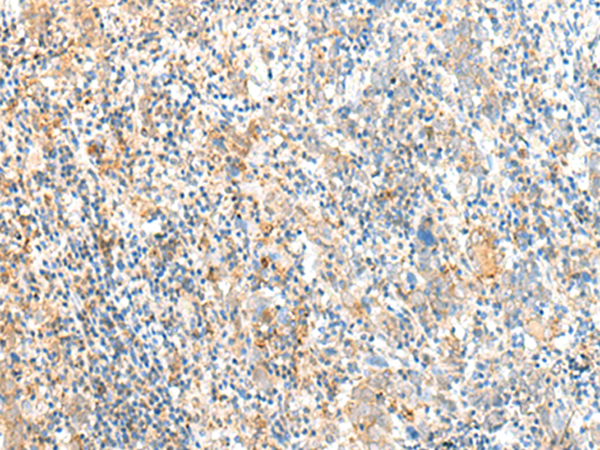 兔抗MCFD2多克隆抗体