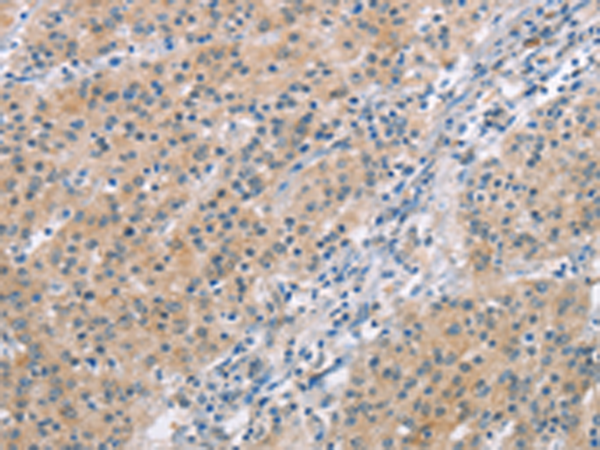 兔抗MCL1多克隆抗体