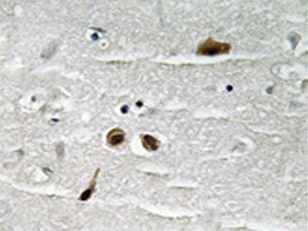 兔抗MDC1(Phospho-Ser513)多克隆抗体