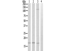  兔抗UBE2D2多克隆抗体  