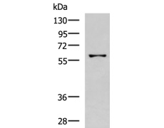兔抗ANGPTL3多克隆抗体