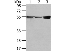 兔抗UGT1A10多克隆抗体  