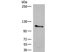 兔抗AP2B1多克隆抗体