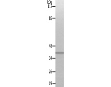 兔抗VDR(Ab-51) 多克隆抗体  