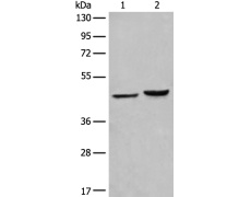 兔抗ARRB2多克隆抗体