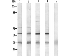 兔抗B3GALT1多克隆抗体