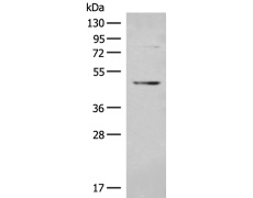 兔抗BMP3多克隆抗体