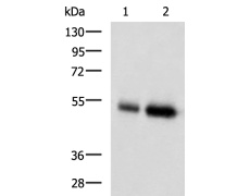 兔抗BMP5多克隆抗体