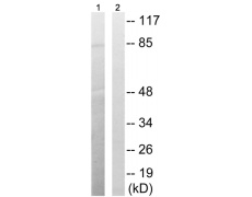 兔抗BRAF(Phospho-Thr753)多克隆抗体