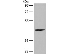 兔抗C11orf49多克隆抗体