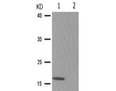 兔抗CALM3(Phospho-Thr79/Ser81)多克隆抗体