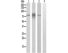 兔抗CAPN11多克隆抗体