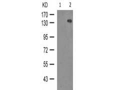 兔抗CASR(Phospho-Thr888)多克隆抗体