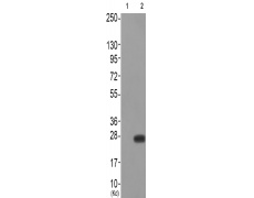 兔抗CAV2(Phospho-Tyr27)多克隆抗体