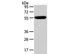 兔抗CBX4多克隆抗体