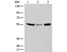 兔抗CCDC102B多克隆抗体