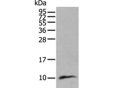 兔抗CCL18多克隆抗体