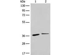 兔抗CCR1多克隆抗体