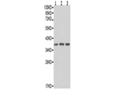兔抗XRCC2多克隆抗体  