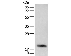 兔抗CD3G多克隆抗体